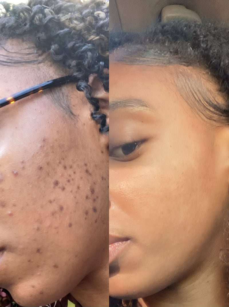 Fades Stubborn "Pregnancy Mask"